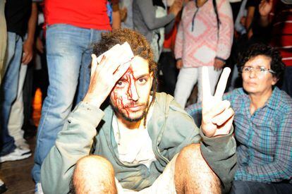 Uno de los heridos en la protesta por la libertad del pederasta.