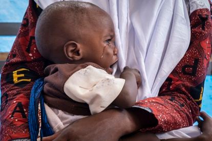 Un niño llora en brazos de su madre mientras espera su turno en el centro de recuperación nutricional de Aguié, al sur de Níger, donde se atiende a los casos moderados.