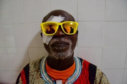 Amaye Sambou, tras la operación de cataratas.