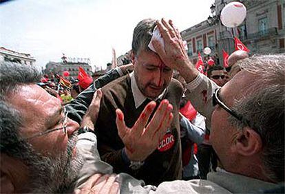 Fidalgo, tras ser golpeado durante la manifestación de hoy en Madrid.