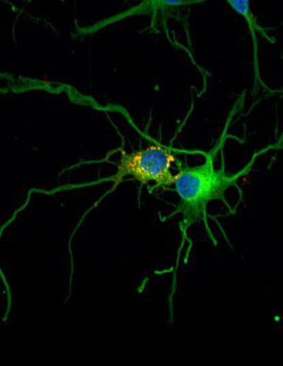 Imagen de dos neuronas.