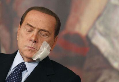 El primer ministro Silvio Berlusconi, con los ojos cerrados y con una gasa en la cara tras una intervención, durante una conferencia de prensa para anunciar cambios en el sistema judicial el pasado 10 de marzo.