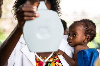 Un bebé mira la báscula antes de ser pesado en una sesión de chequeo médico en República Democrática del Congo. 