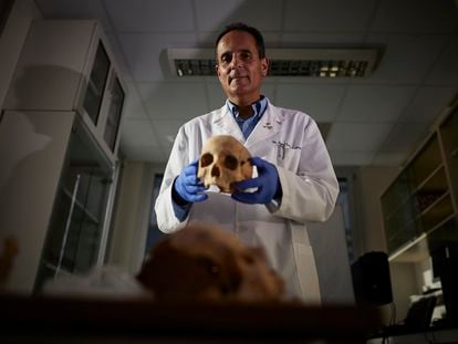 El doctor José Antonio Lorente muestra un cráneo atribuido a Cristóbal Colón de un conjunto de restos óseos procedentes de Guadalajara, en la facultad de Medicina de Granada.