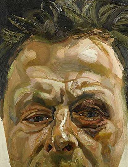 Autorretrato de Lucien Freud que muestra su ojo morado