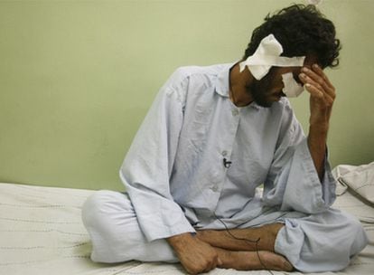 Un hombre al que los talibanes cortaron nariz y orejas por haber intentado votar en las presidenciales afganas, en un hospital de Kabul.