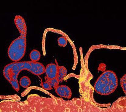 Virus del sarampión (rojo) infectando una célula.