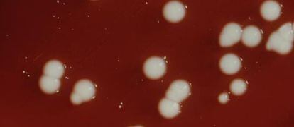 Una muestra de sangre con superbacterias del tipo Klebsiella pneumoniae.