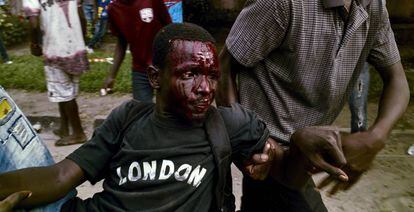 Un manifestante herido tras choques con la polic&iacute;a
