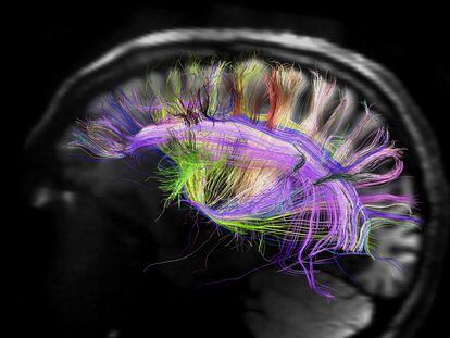 Imagen de una resonancia magnética del cerebro humano que muestra las curvas de fibras neuronales.