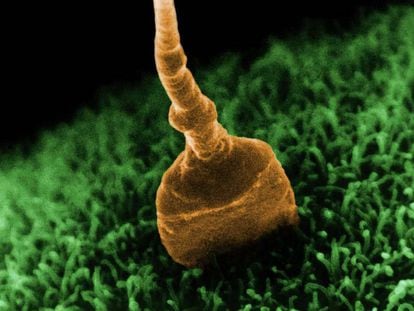 Imagen microsc&oacute;pica de un espermatozoide fecundando un &oacute;vulo