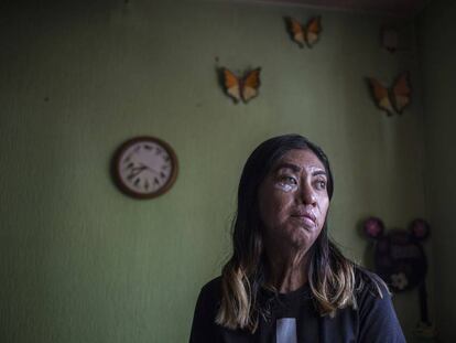 "Pensé que era la única" sobrevivientes de ataques con ácido en México
