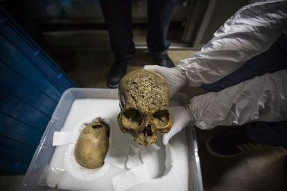 Bajo llave se guardan 300 cráneos con huellas de epidemias y deformaciones. En la imagen, un cráneo proveniente de Coahuila, de 1.000 años de antigüedad, afectado por la sífilis. Esto muestra que la enfermedad ya existía antes de la llegada de los españoles a América.