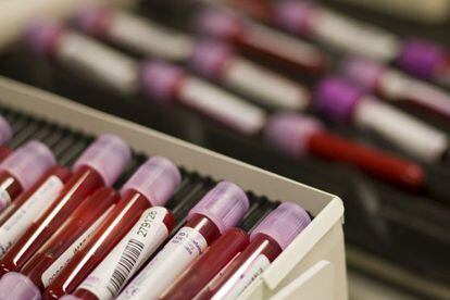 Muestras de sangre analizadas en un laboratorio. 