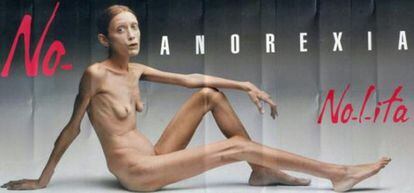 Ha fallecido Isabelle Caro, enferma de anorexia desde los 13 años, quien se dio a conocer en 2007 a través de una campaña publicitaria de la firma de ropa Benetton que pretendía concienciar sobre el horror de esta dolencia.