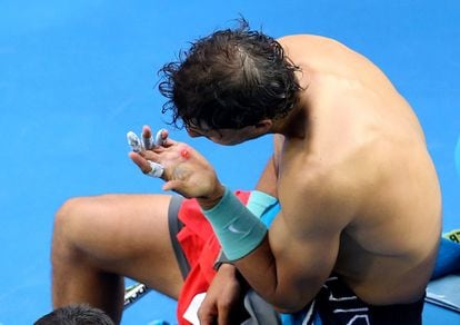 Rafael Nadal se mira una ampolla que tiene en la mano durante el partido de octavos contra el japones Kei Nishikori, 20 de enero de 2014.