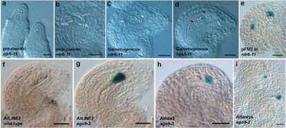 Imagen microscópica de células de una mutante de la planta 'Arabidopsis', en la que se observa la falta de expresión de la proteína argonauta 9, con desarrollo de células reproductoras femeninas anormales (marcadas y señaladas con flechas).