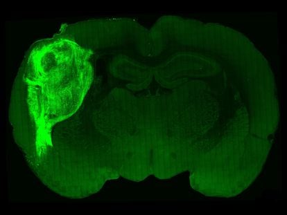 Un organoide cerebral humano, marcado con una proteína fluorescente y trasplantado al cerebro de una rata.