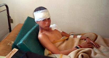 Niño herido en un hospital de Hama (Siria).