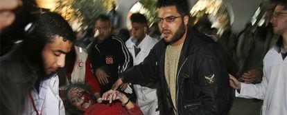 Una joven palestina acude al Hospital de Shifa, en Gaza, tras ser alcanzada en uno de los ataques.
