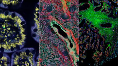 Tres imágenes de la estructura celular del intestino delgado (izquierda), riñón (centro) y placenta.