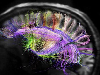 Imagen de resonancia magnética del cerebro humano.