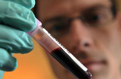 Un científico sostiene una muestra de sangre en el Laboratorio para el Análisis del Dopaje de Suiza.