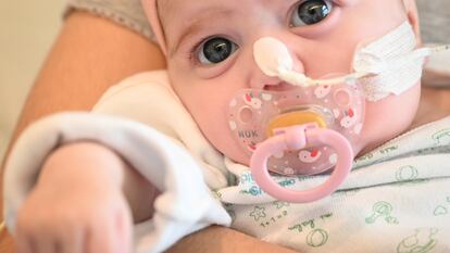 Naiara, de dos meses, tras recibir un trasplante de corazón.