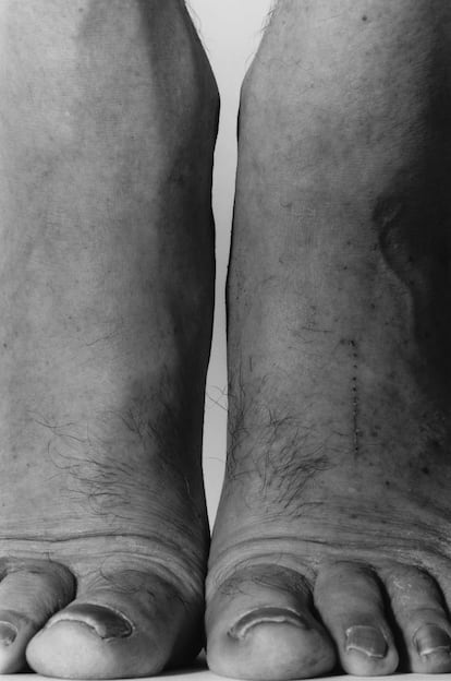 Feet, Frontal, 1984 (Pie. Frontal)
