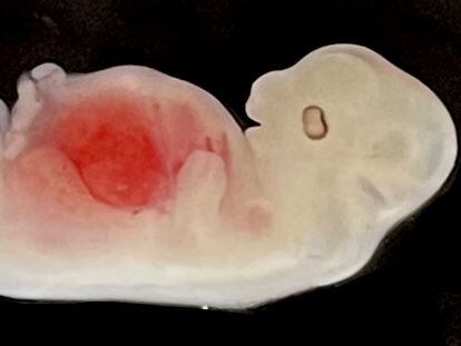 Un embrión porcino de 28 días, con un esbozo de riñón humano. Foto cedida por GIBH.
