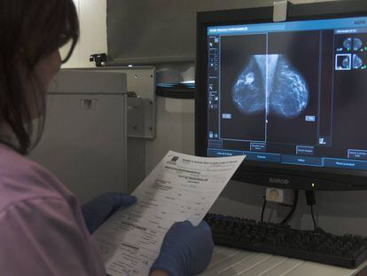 Revisión de una mamografía.