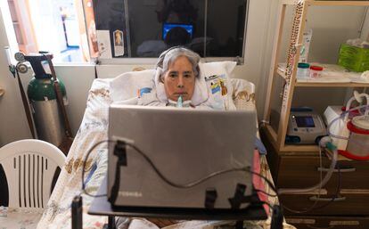 María Benito, una peruana con esclerosis lateral amiotrófica (ELA) en etapa avanzada.