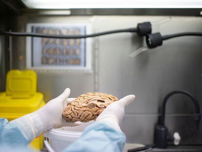 Un cerebro del banco de tejidos de la Fundación CIEN, en Madrid.