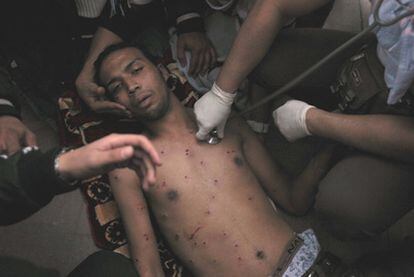 Un herido en una de las manifestaciones celebradas ayer en El Cairo es atendido en plena calle.