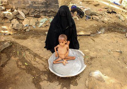 Moaz Ali Mohammed, un niño yemení de dos años de edad y que sufre malnutrición, es bañado por su madre en las inmediaciones de su casa ubicada en el distrito de Aslam, en la provincia de Hajjah (Yemen).