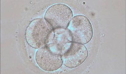 Embrión humano en estado de 8 células ( 3 días de desarrollo embrionario in vitro)