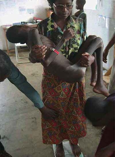 Una enfermera atiende a un niño en un centro africano de Save the Children.