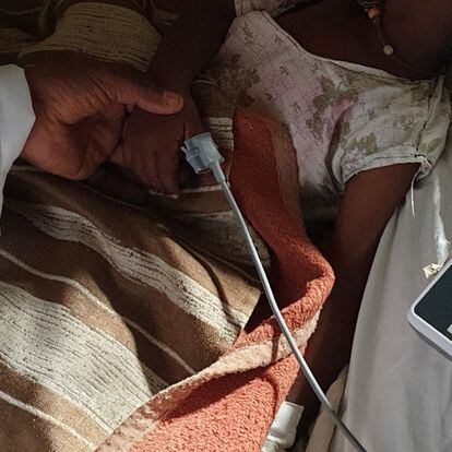 Un médico del hospital rural de Gambo (Etiopía) mide la oxigenación en sangre de un paciente con bronquiolitis.