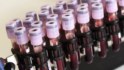 Muestras de sangre en un tubo de ensayo de un laboratorio.