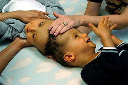 Los niños siameses Ahmed y Mohamed Ibrahim, durante una reciente visita al Hospital Infantil de Dallas.