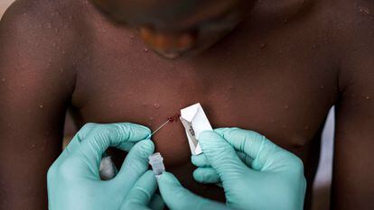Un equipo toma una muestra del virus, en una aldea del Congo.