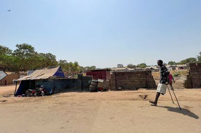 Un hombre con una pierna amputada atraviesa un poblado de chabolas en Yuba.