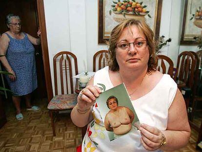Juana Ledesma muestra una fotografía con el estado de sus pechos tras las intervenciones.