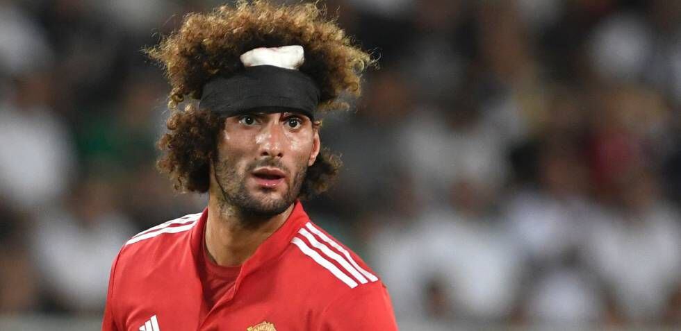 Fellaini con la venda en la cabeza tras chocar con Sergio Ramos.