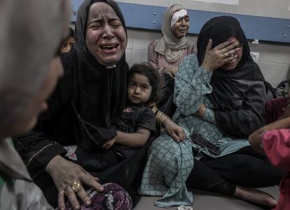 Palestinos heridos en el hospital Al Shifa de Gaza, el 17 de octubre.
