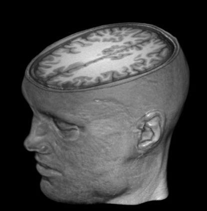 Una imagen del cerebro de Garéyev