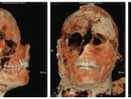 Una tomografía axial computarizada de una de las momias de Pompeya.