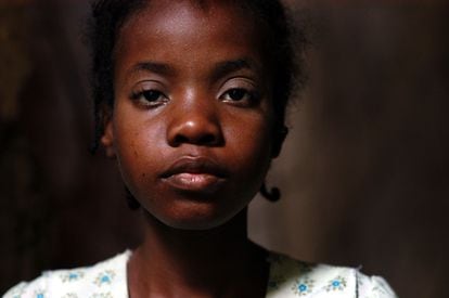 Flegana Fliss, a girl who was born HIV positive and who was admitted to the Zanmi Lasante Hospital for HIV carriers in Haiti.