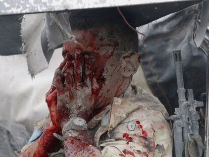 Uno de los militares italianos heridos en la explosión