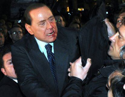 Berlusconi, poco después de ser agredido el 13 de diciembre de 2009 en Milán por Massimo Tartaglia, un hombre de 42 años con desequilibrios mentales, que atizó al primer ministro italiano con una reproducción de la catedral de la ciudad (imagen proporcionada por la oficina del primer ministro italiano).